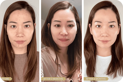 Clinical Results & Real Skin Transformations
